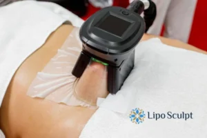 Does Fat Freezing At Home Work? 3 Fat freezing at home from Lipo Sculpt Cheltenham
